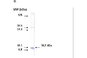 Western blot on recombinant protein corresponding to C-terminal region of CYP26A1 protein using CYP26A1 antibody. (CYP26A1 antibody  (C-Term))
