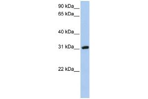 WB Suggested Anti-DKKL1 Antibody Titration: 0.