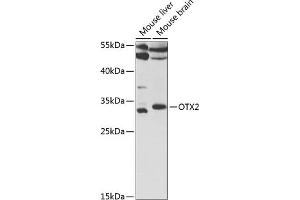 Western blot analysis of extracts of various cell lines, using OTX2 antibody (ABIN6131791, ABIN6145091, ABIN6145093 and ABIN6221138) at 1:1000 dilution. (OTX2 antibody  (AA 140-280))