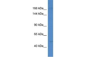 WB Suggested Anti-Setd5 Antibody   Titration: 1. (SETD5 antibody  (N-Term))