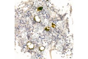 Immunohistochemistry of paraffin-embedded rat bone marrow using GP9 Rabbit pAb (ABIN6127598, ABIN6141293, ABIN6141294 and ABIN6221019) at dilution of 1:25 (40x lens). (CD42a antibody  (AA 17-147))