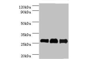 Western blot All lanes: B-cell lymphoma/leukemia 10 antibody at 9 μg/mL Lane 1: Mouse gonad tissue Lane 2: MCF-7 whole cell lysate Lane 3: NIH/3T3 whole cell lysate Secondary Goat polyclonal to rabbit IgG at 1/10000 dilution Predicted band size: 26 kDa Observed band size: 26 kDa (Cyclin D1 antibody  (AA 1-233))