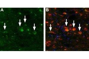Expression of Mucolipin 3 in mouse brain stem - Immunohistochemical staining of TRPML3 in mouse brain stem using Anti-TRPML3 (Mucolipin 3) Antibody (ABIN7043338 and ABIN7044043). (Mucolipin 3 antibody  (Cytoplasmic Domain, Intracellular))