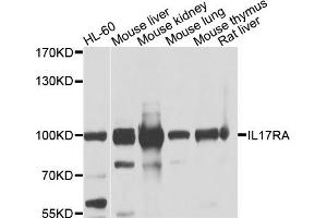 Western blot analysis of extracts of various cell lines, using IL17RA antibody. (IL17RA antibody)