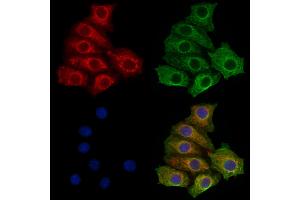 ABIN7094729 and ABIN7098780 staining HepG2 cells by IF/ICC. (STS antibody  (C-Term))