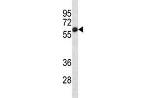 Western Blotting (WB) image for anti-Alkaline Phosphatase (ALP) (AA 56-83) antibody (ABIN3029911)