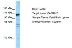 Image no. 1 for anti-Caprin Family Member 2 (CAPRIN2) (AA 924-973) antibody (ABIN6750090) (CAPRIN2 antibody  (AA 924-973))