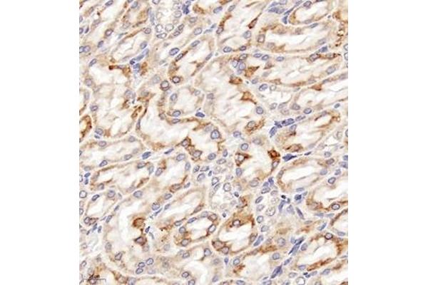 Chloride Channel 5 antibody