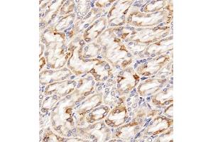 Immunohistochemistry of paraffin embedded rat kidney using Clcn5 (ABIN7073471) at dilution of 1:200 (400x lens)