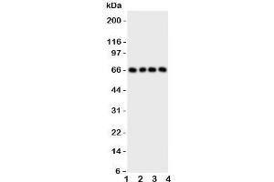 Western blot testing of PTH1R antibody and Lane 1:  SKOV;  2: U20S;  3: HeLa;  4: SMMC-7721 cell lysate;  Observed/expected size ~66KD (PTH1R antibody  (C-Term))