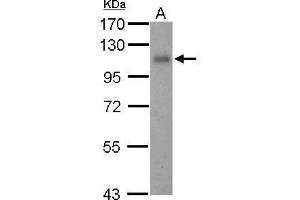 WB Image Sample (30 ug of whole cell lysate) A: THP-1 7. (Thrombomodulin antibody  (C-Term))