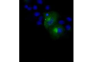 Image no. 12 for anti-Amyloid beta (A4) Precursor Protein (APP) antibody (ABIN1496877) (APP antibody)