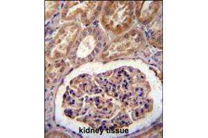 MGP Antibody immunohistochemistry analysis in formalin fixed and paraffin embedded human kidney tissue followed by peroxidase conjugation of the secondary antibody and DAB staining. (MGP antibody  (AA 37-66))