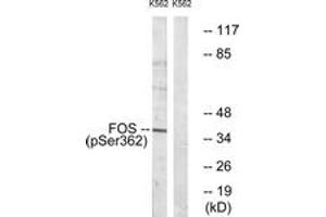 Western blot analysis of extracts from K562 cells treated with forskolin 40nM 30', using Fos (Phospho-Ser362) Antibody. (c-FOS antibody  (pSer362))