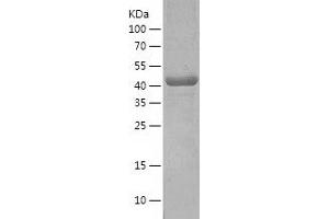 Western Blotting (WB) image for ARC (AA 1-396) protein (His tag) (ABIN7287744) (ARC (AA 1-396) protein (His tag))