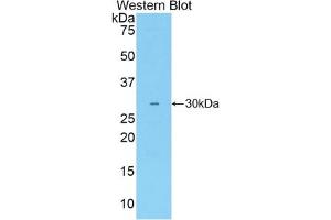 Detection of Recombinant ALCAM, Rabbit using Polyclonal Antibody to Activated Leukocyte Cell Adhesion Molecule (ALCAM) (CD166 antibody  (AA 225-478))