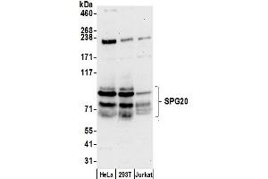 anti-Spastic Paraplegia 20 (Troyer Syndrome) (SPG20) (AA 350-400) antibody