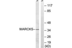 Western blot analysis of extracts from Jurkat cells, using MARCKS (Ab-158) Antibody. (MARCKS antibody  (AA 126-175))