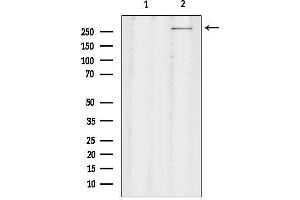 anti-Chromodomain Helicase DNA Binding Protein 8 (CHD8) (C-Term) antibody