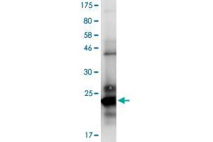 Image no. 2 for Tumor Necrosis Factor (Ligand) Superfamily, Member 13b (TNFSF13B) (AA 136-285) protein (His-DYKDDDDK-Strep II Tag) (ABIN1323223)
