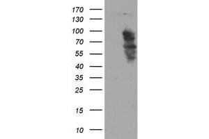 Western Blotting (WB) image for anti-SRY (Sex Determining Region Y)-Box 5 (SOX5) antibody (ABIN1501082) (SOX5 antibody)