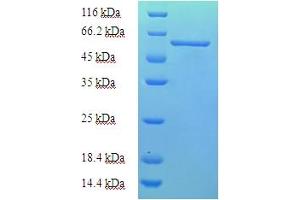 SDS-PAGE (SDS) image for AarF Domain Containing Kinase 2 (ADCK2) (AA 200-609) protein (His-SUMO Tag) (ABIN4976890)