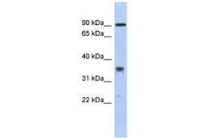 Image no. 1 for anti-Chromosome 6 Open Reading Frame 154 (C6orf154) (AA 179-228) antibody (ABIN6743771) (C6orf154 antibody  (AA 179-228))