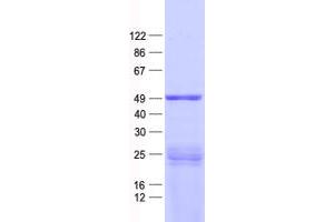 Validation with Western Blot (PPP1R36 Protein (His tag))