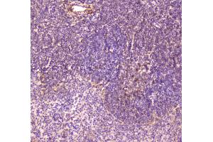 IHC analysis of CD163 using anti-CD163 antibody . (CD163 antibody  (AA 47-201))