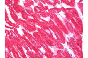 Anti-ACTC1 / Alpha Cardiac Actin antibody IHC staining of human heart. (ACTC1 antibody  (AA 99-354))