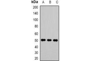 Western blot analysis of VRK1 expression in Jurkat (A), A549 (B), Hela (C) whole cell lysates.