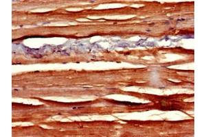Immunohistochemistry of paraffin-embedded human skeletal muscle tissue using ABIN7169811 at dilution of 1:100 (SLIT3 antibody  (AA 1199-1494))