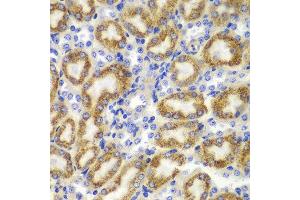 Immunohistochemistry of paraffin-embedded mouse kidney using TNFSF11 antibody at dilution of 1:100 (400x lens).