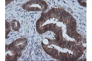 Image no. 1 for anti-Cytidine Monophosphate (UMP-CMP) Kinase 1, Cytosolic (CMPK1) antibody (ABIN1497541) (Cytidine Monophosphate (UMP-CMP) Kinase 1, Cytosolic (CMPK1) antibody)