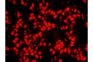 Immunofluorescence (IF) image for anti-Nucleophosmin (Nucleolar phosphoprotein B23, Numatrin) (NPM1) (AA 250-294) antibody (ABIN7448992) (NPM1 antibody  (AA 250-294))