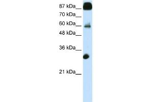 WB Suggested Anti-CTCF Antibody Titration:  0. (CTCF antibody  (N-Term))