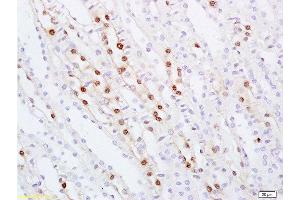 Formalin-fixed and paraffin embedded rat kidney tissue labeled with Anti ZHX2/Alpha fetoprotein regulator 1 Polyclonal Antibody, Unconjugated  at 1:100 followed by conjugation to the secondary antibody and DAB staining (ZHX2 antibody  (AA 451-550))