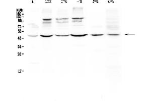 Western blot analysis of DC-SIGN using anti-DC-SIGN antibody .