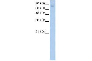 WB Suggested Anti-CACNB2 Antibody Titration:  2. (CACNB2 antibody  (Middle Region))