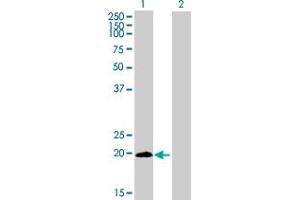 Western Blot analysis of LYPD5 expression in transfected 293T cell line by LYPD5 MaxPab polyclonal antibody. (LYPD5 antibody  (AA 1-208))
