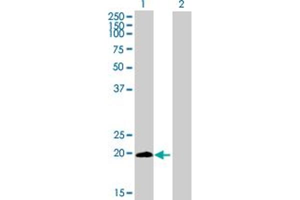 LYPD5 anticorps  (AA 1-208)