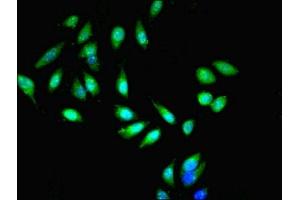 Immunofluorescent analysis of Hela cells cells using ABIN7151063 at dilution of 1:100 and Alexa Fluor 488-congugated AffiniPure Goat Anti-Rabbit IgG(H+L) (MIB1 antibody  (AA 5-332))