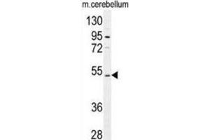 Western Blotting (WB) image for anti-Cyclic Nucleotide Gated Channel alpha 4 (CNGA4) antibody (ABIN2996392)