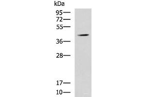 Western blot analysis of Mouse liver tissue lysate using SPI1 Polyclonal Antibody at dilution of 1:1600 (SPI1 antibody)