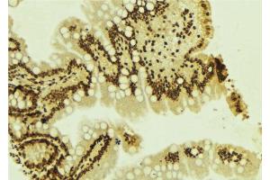 ABIN6277656 at 1/100 staining Mouse colon tissue by IHC-P. (ZEB1 antibody  (Internal Region))