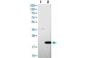 Western blot analysis of Lane 1: Negative control (vector only transfected HEK293T lysate), Lane 2: Over-expression Lysate (Co-expressed with a C-terminal myc-DDK tag (~3. (COMMD8 antibody)