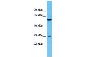Host: Rabbit Target Name: TMPRSS11E Sample Type: Fetal Lung lysates Antibody Dilution: 1. (TMPRSS11E antibody  (N-Term))
