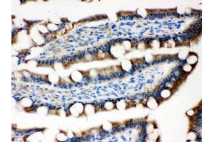Immunohistochemistry (IHC) image for anti-serpin Peptidase Inhibitor, Clade B (Ovalbumin), Member 5 (SERPINB5) (AA 1-350) antibody (ABIN3043330)
