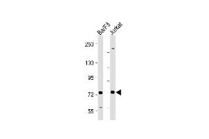All lanes : Anti-Syk(/526) Antibody at 1:2000 dilution Lane 1: Ba/F3 whole cell lysate Lane 2: Jurkat whole cell lysate Lysates/proteins at 20 μg per lane. (SYK antibody  (AA 500-530))