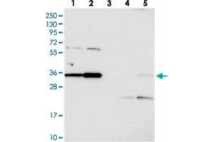 Western blot analysis of Lane 1: RT-4, Lane 2: U-251 MG, Lane 3: Human Plasma, Lane 4: Liver, Lane 5: Tonsil with C3orf26 polyclonal antibody  at 1:250-1:500 dilution. (CMSS1 antibody)
